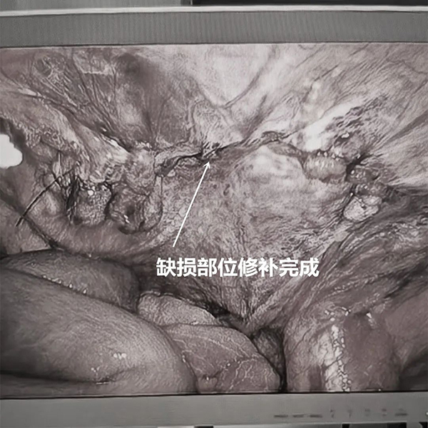 1ff585e54efa4f8025ffe18618004fc_.jpg