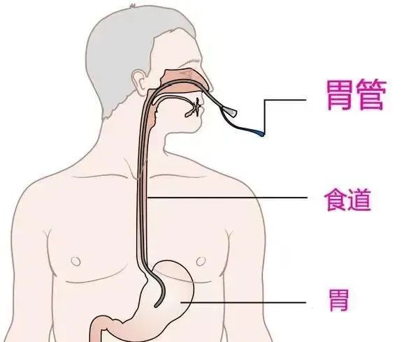 ͼƬ